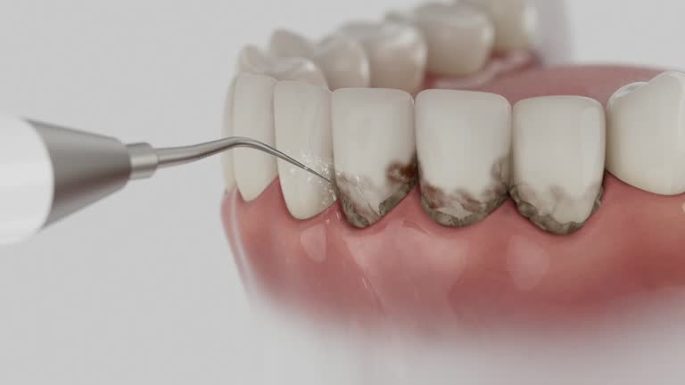 Trusted Teeth Cleaning And Checkup service in Oakville, MO - Dentist Open Now